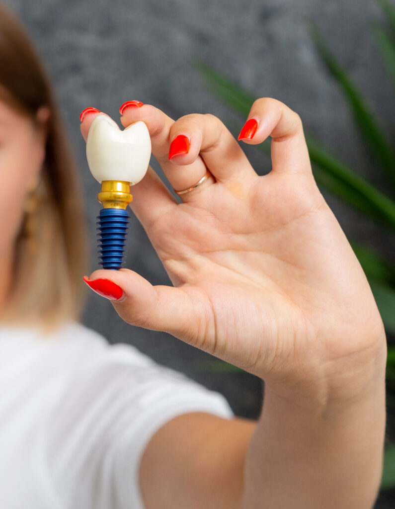 A dental expert demonstrating full mouth dental implants for smile restoration in Baton Rouge, LA