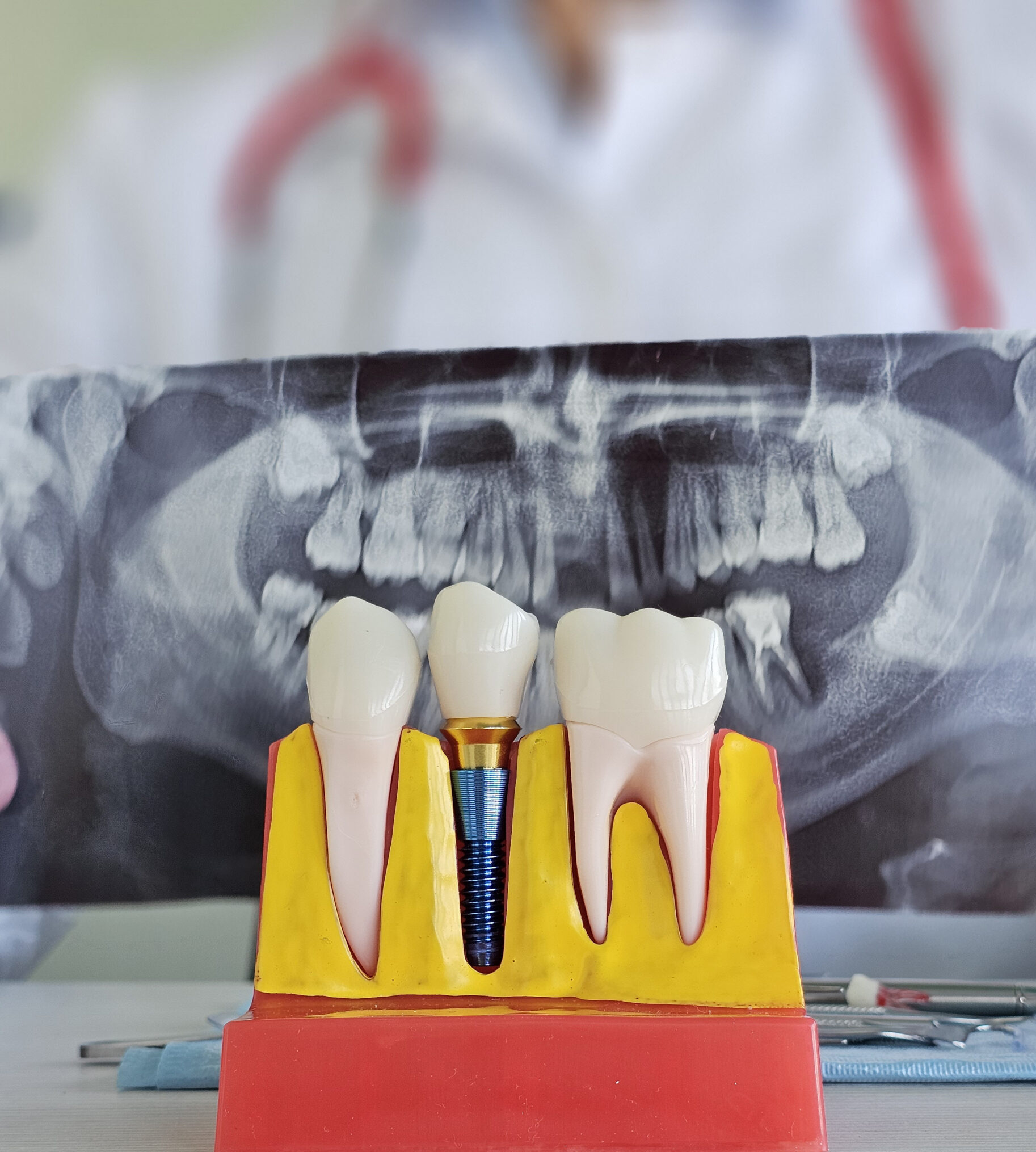 A dentist explaining full mouth dental implant solutions in Baton Rouge, Louisiana