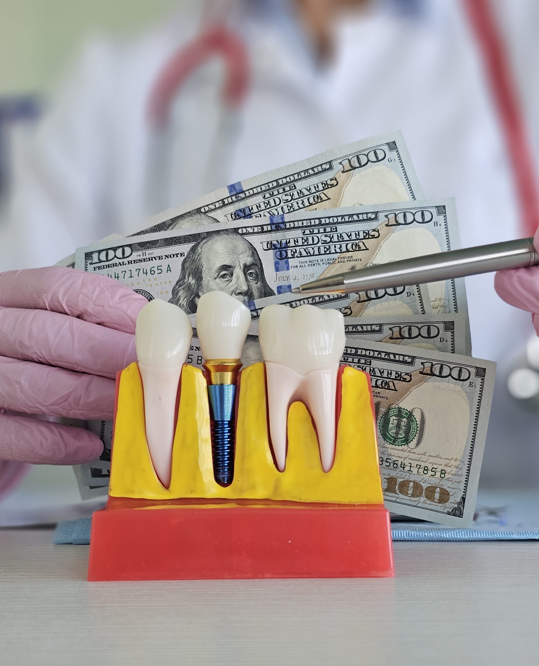 A dentist highlighting full mouth dental implant treatment options in Baton Rouge, Louisiana