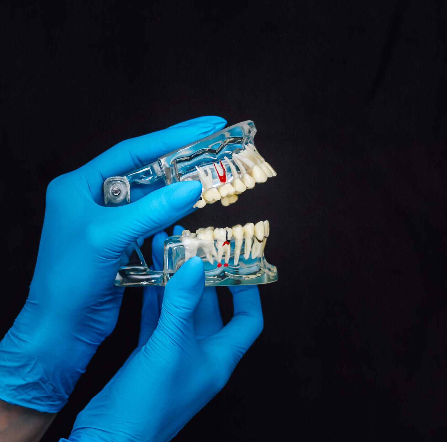 A dentist showing a model of all-on-x dental implants in Baton Rouge, LA