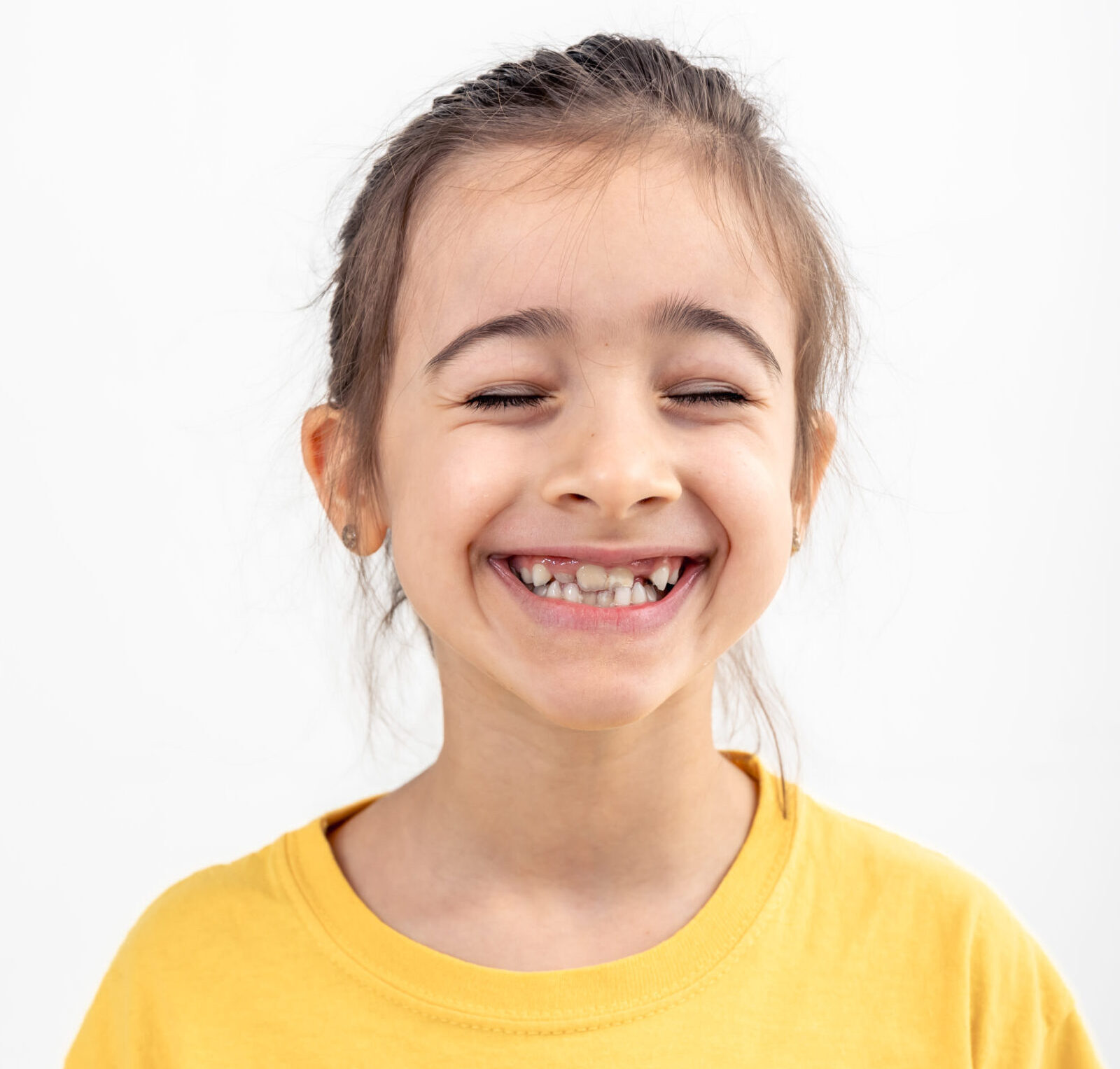 A little girl showing her crooked teeth